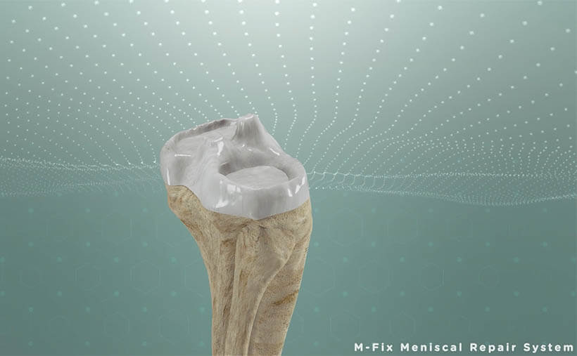 TULPARMED 3D ANİMASYON FİLMİ-1